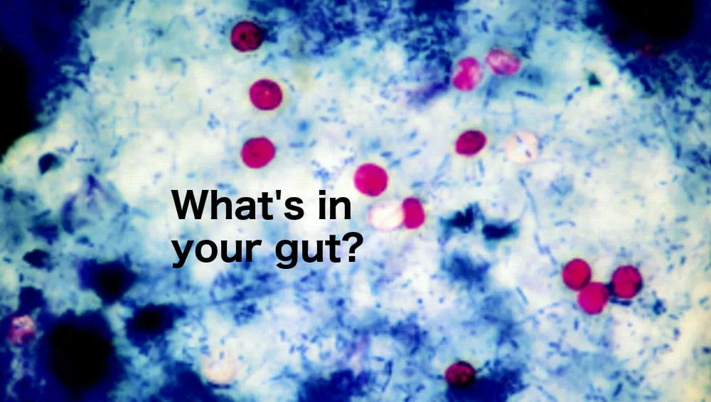 Foodsafetynews